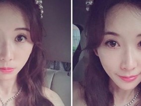 女生整容过度真的不好吗？如何判断整容是否过度？