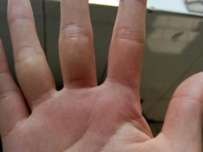 从手相看婚姻不顺，你需要了解的几种情况（手相解读婚姻不顺的原因及应对方法）