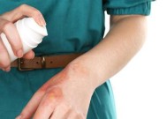 被烫伤后应如何进行家庭急救处理？