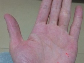 手指测试能预测未来婚姻吗？如何进行准确的婚姻状况分析？