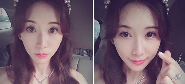 女生整容过度真的不好吗？如何判断整容是否过度？  第1张