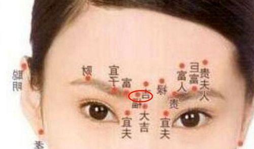 人身上长痣是什么原因？痣的形成与哪些因素有关？  第2张