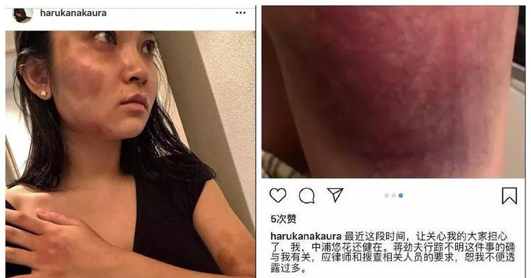 如何自救家暴行为？制止家暴的有效手段有哪些？  第2张
