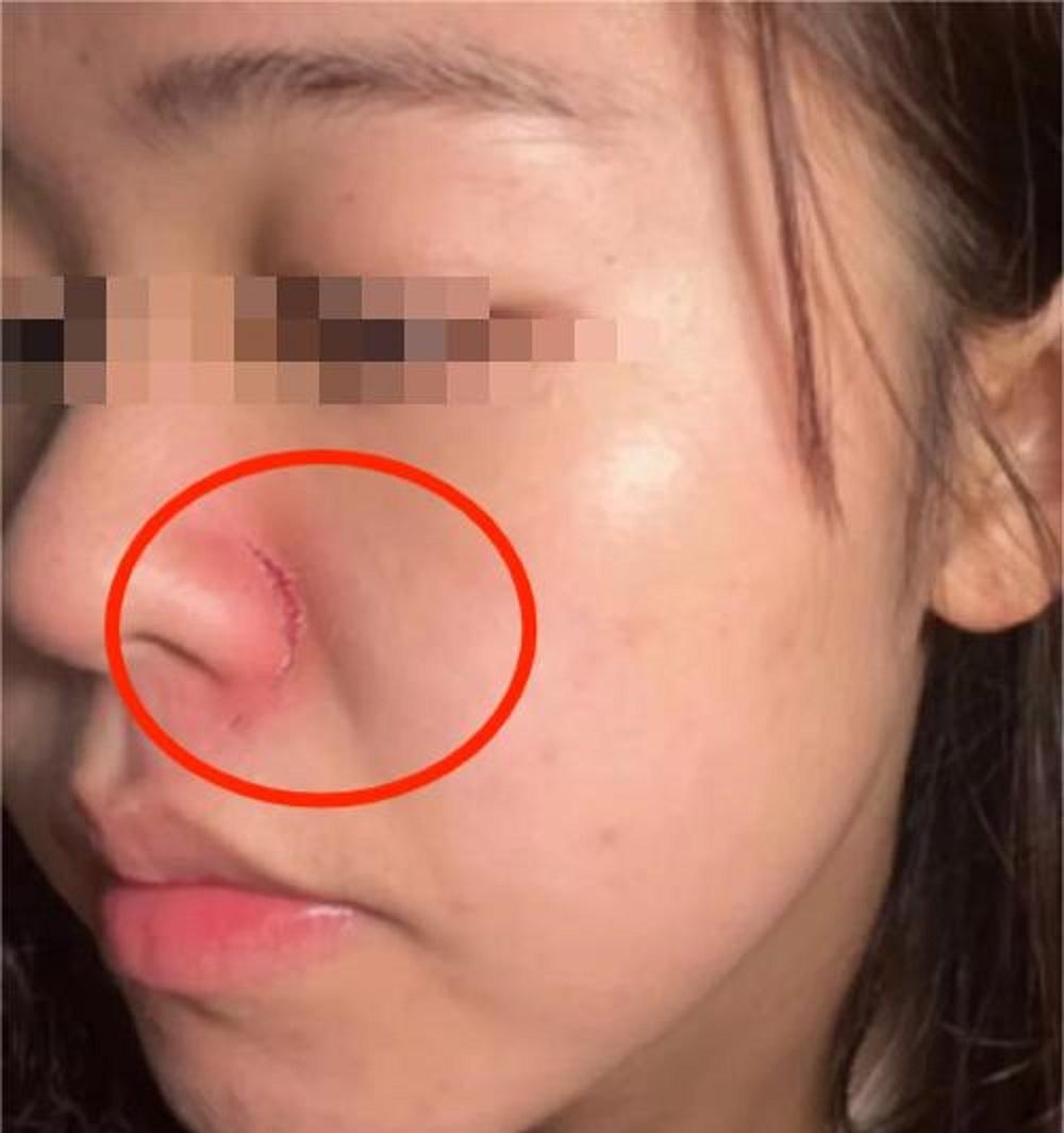 大妈要求让座被拒，出手打伤女乘客，当事人发声，家属拒不道歉  第23张